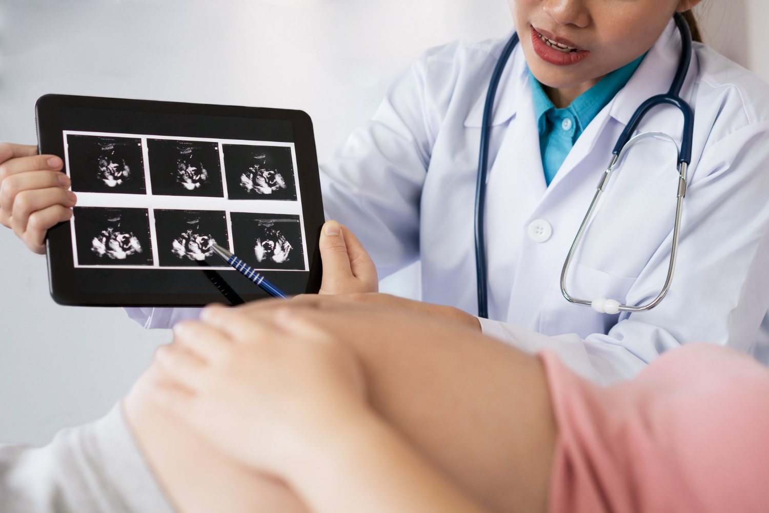 Pregnancy Ultrasound